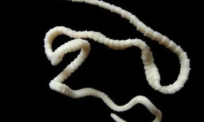 wie man den Cestodenparasiten aus dem Körper entfernt